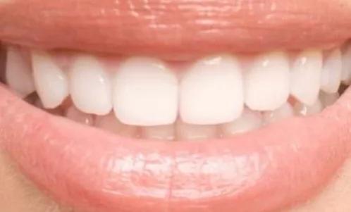 After treatment